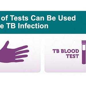 Tuberculosis (TB) - Testing and Diagnosis There are two kinds of tests to detect TB bacteria in the body.